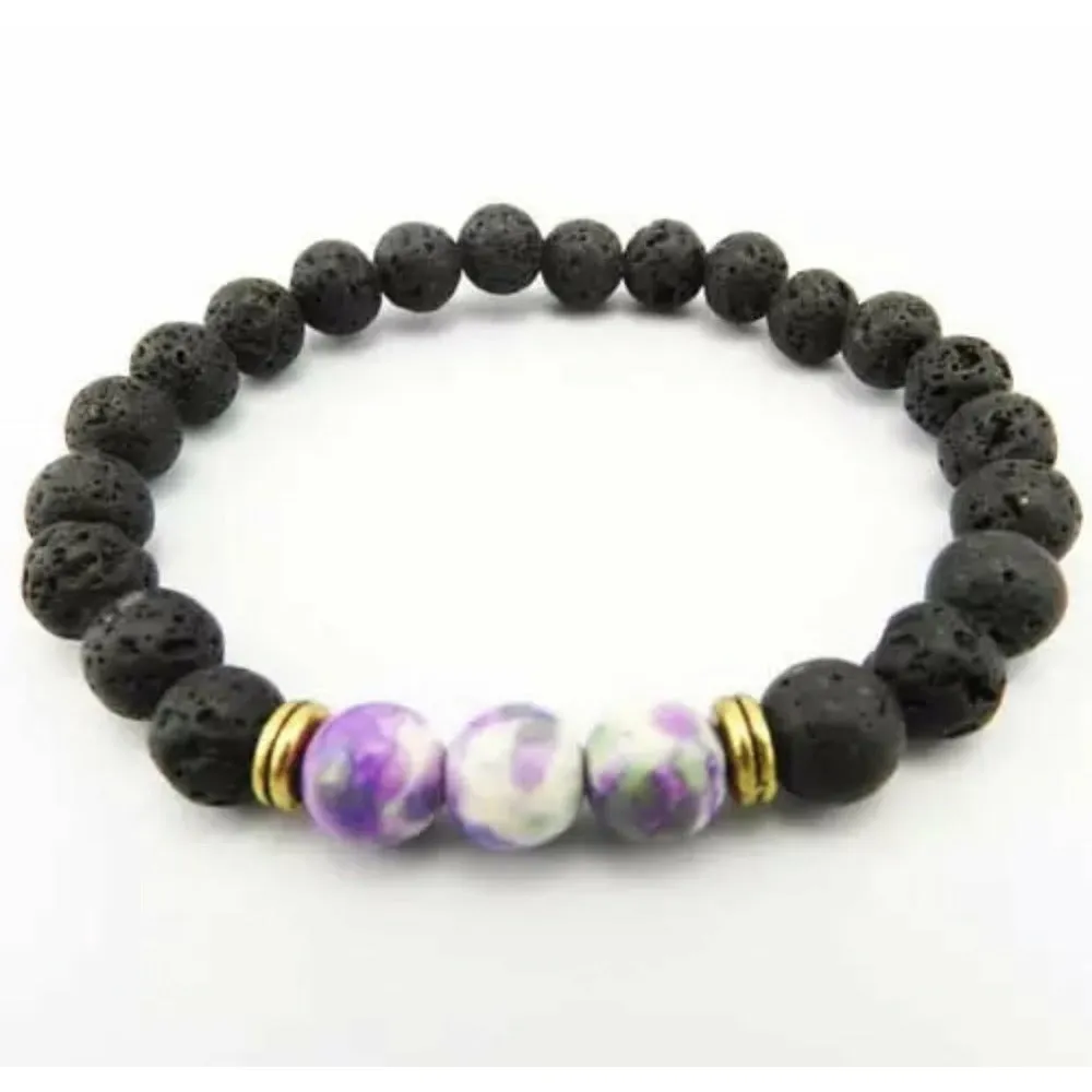 Marble Diffuser Bracelet